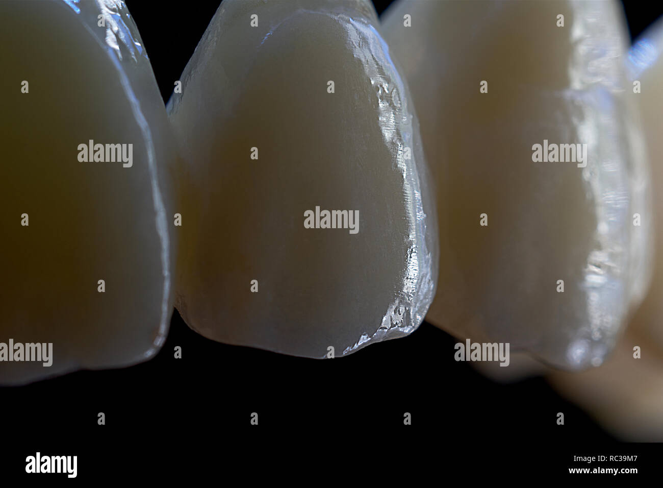Ceramic zirconia teeth Stock Photo Alamy
