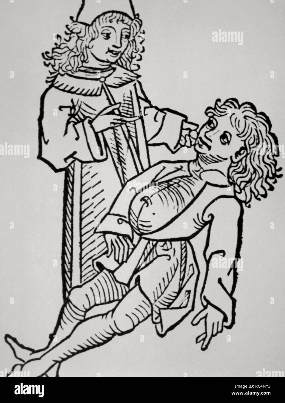 History of medicine. Modern Age. Belly infaldo. Cirrhosis.Woodcut. Hortus Sanitatis. 14th century. Stock Photo