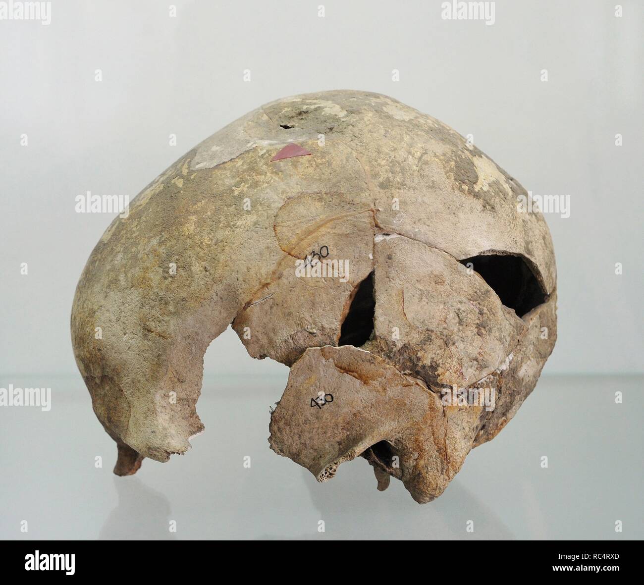 Poland. Prehistory. Human skull with marked trace of the blow with a blunt instrument. It is presented in a permanent exhibition 'Disease prehistoric population on Polish soil'. Archaeological Museum. Gdansk. Poland. Stock Photo