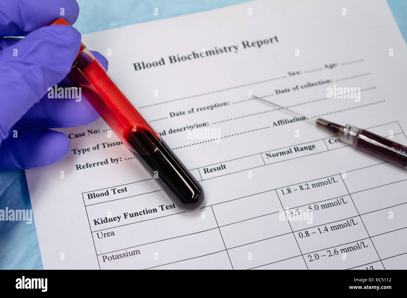 Collection of blood for blood biochemistry analysis for metabolic diseases Stock Photo