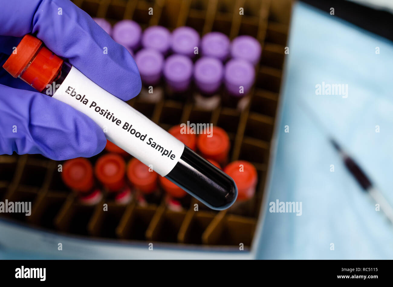 Doctor showing Ebola positive blood sample Stock Photo