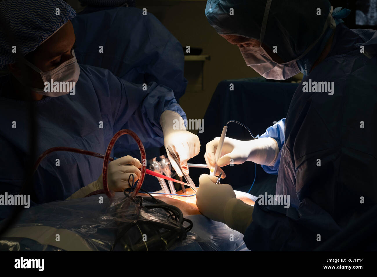 Doctors performing spine surgery using neuronavigation computer-assisted technology system Stock Photo