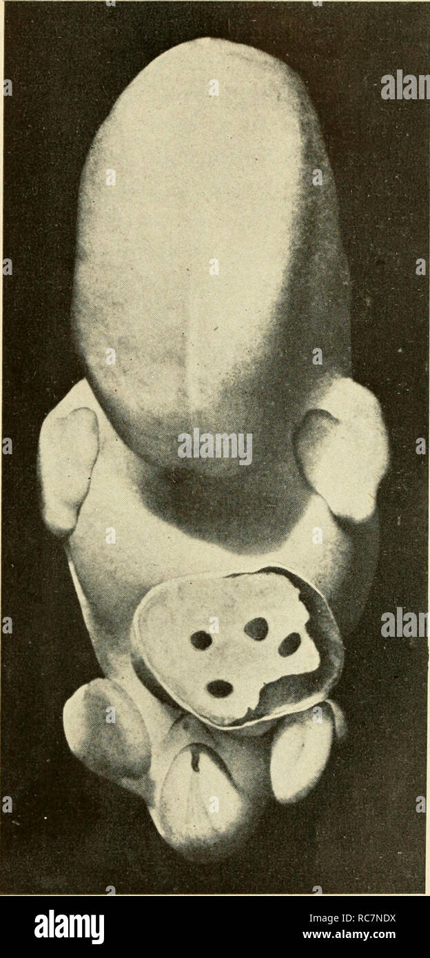 Human embryo 6 weeks hi-res stock photography and images - Alamy