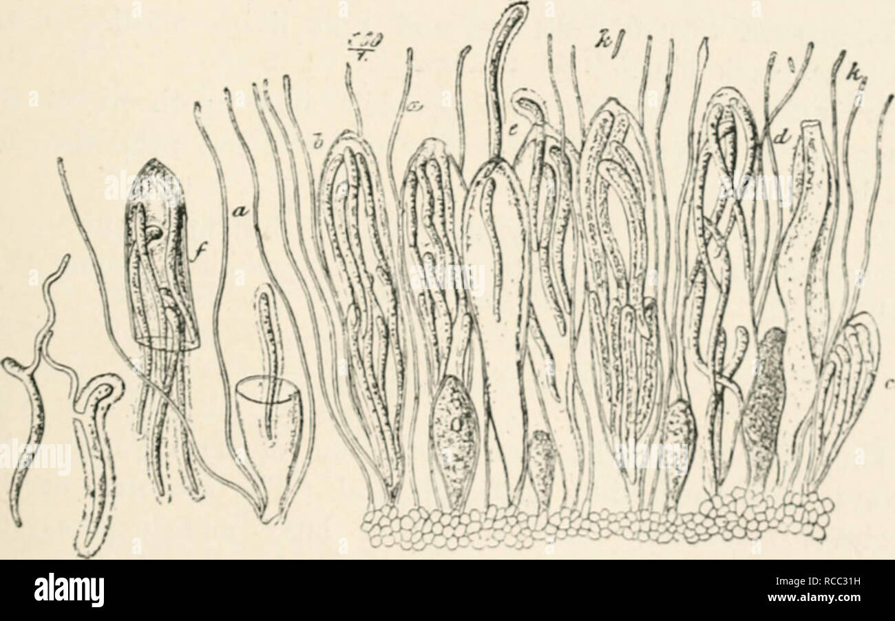 . Diseases of plants induced by cryptogamuc parasites; introduction to the study of pathogenic fungi, slime-fungi, bacteria, and algae. English ed. by William G. Smith. Plant diseases; Parasitic plants. Fio. 125.âLophodermium nervisequium. Section of a needle of Silver Fir. b, Pycnidium on upper surface shedding conidia. n, AjKJthe- cium on the lower surface. (After R. Hartig.). Fig. 126.âLophodermium neiviiequiuiu on Silver Fir. Portion of a riiH; aiH&gt;the- ciuna. an. Filamentous paraphyses ; rod-like ccIIh (conidia V), *â¢, abjointol from the anex of tllt; Ii:ll*:inli'uÂ«*w * tln^ ii..ci  Stock Photo