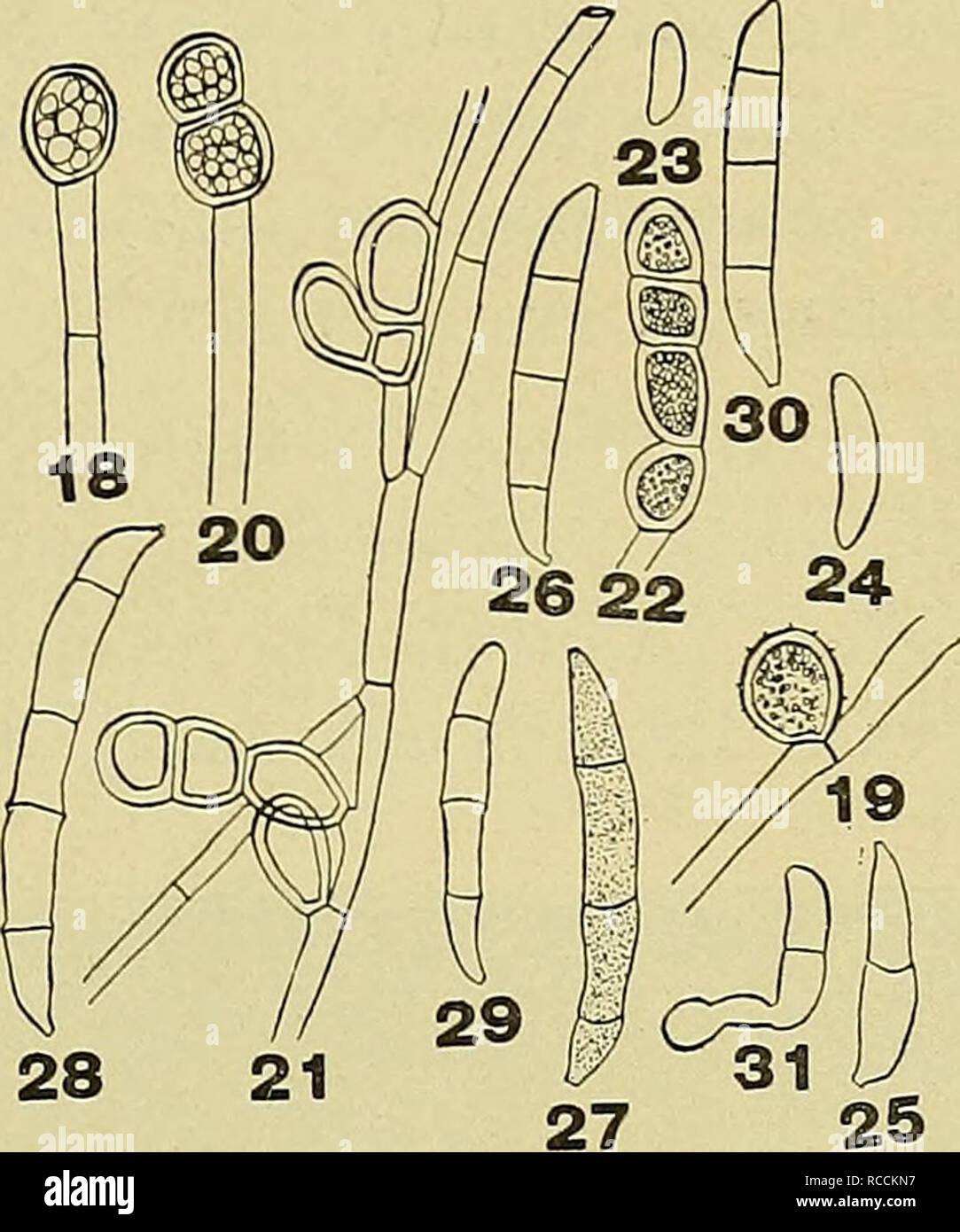 . The diseases of the sweet pea ... Sweet peas. 31 presenting a granular appearance. In young cultures the outer wall of the chlamydospore is smooth, but in old cultures it becomes slightly warty or covered with minute points (Fig. 19). No perfect stage has been found to accompany this fungus either in pure culture or on the host.. Fisrs. 18-31. Fusarium lathvri. showing chlamvdosDores and conidia. Identity of the Fungus. There is no doubt but that the fun- gus belongs to the genus Fusarium. It produces its micro- and macro- spores (sickle shaped) as well as chlamydospores which according to W Stock Photo