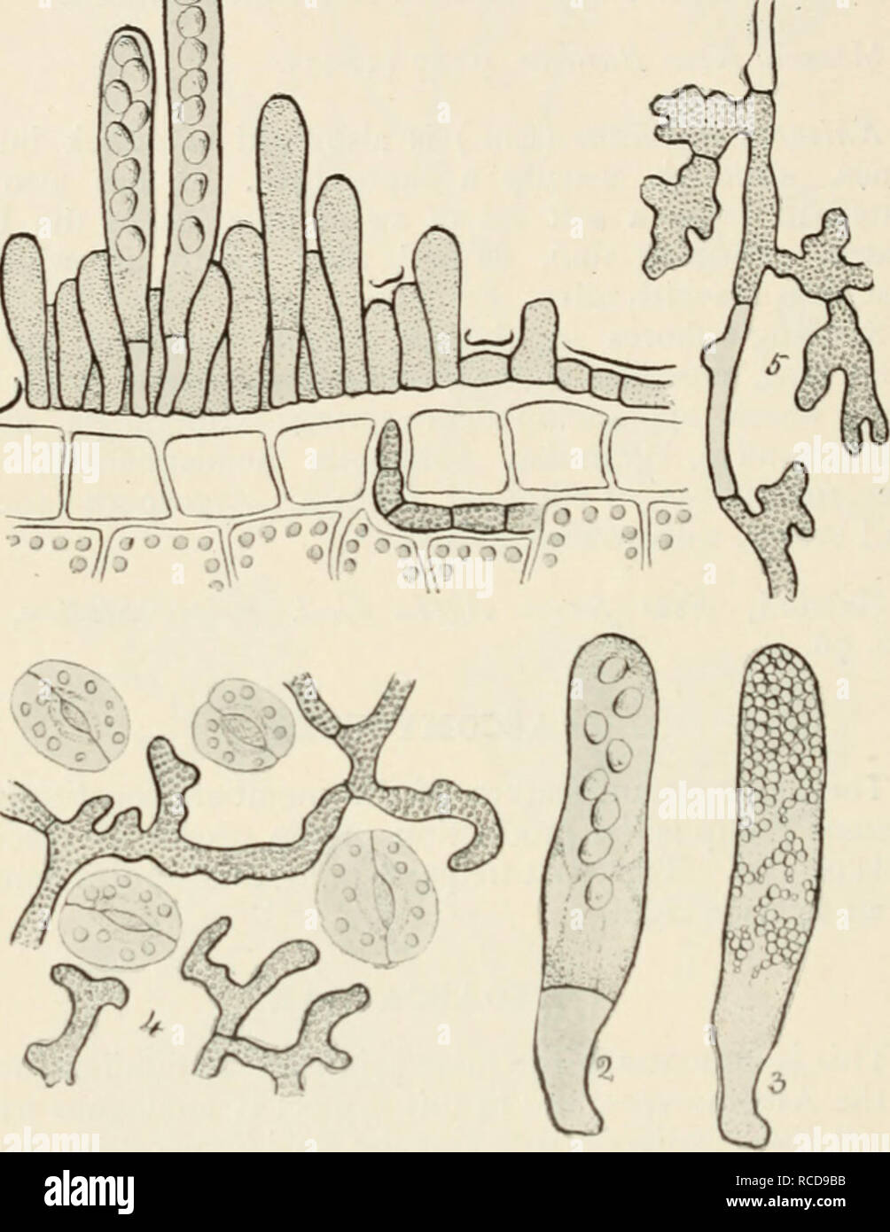 . Diseases of cultivated plants and trees. Plant diseases; Plants -- Wounds and injuries; Plants, Protection of; Trees -- Diseases and pests. Fig. 31. I, lixoascus deformans, sliowing asci in various stages of development burslinR through the cuticle of the leaf; 2, ascus of Exoanus pruni, showing stalk-cell at base of ascus, and eight spores; 3, ascus of Taphritia aiirca filled with secondary spores produced by budding of the ascospores ; 4, surface view of niycelium of Taphrina Sadcbcckii on leaf of Almes glutinosa ; 5, differentiation of fertile or ascogenous hyphae from vegetative hyphae o Stock Photo