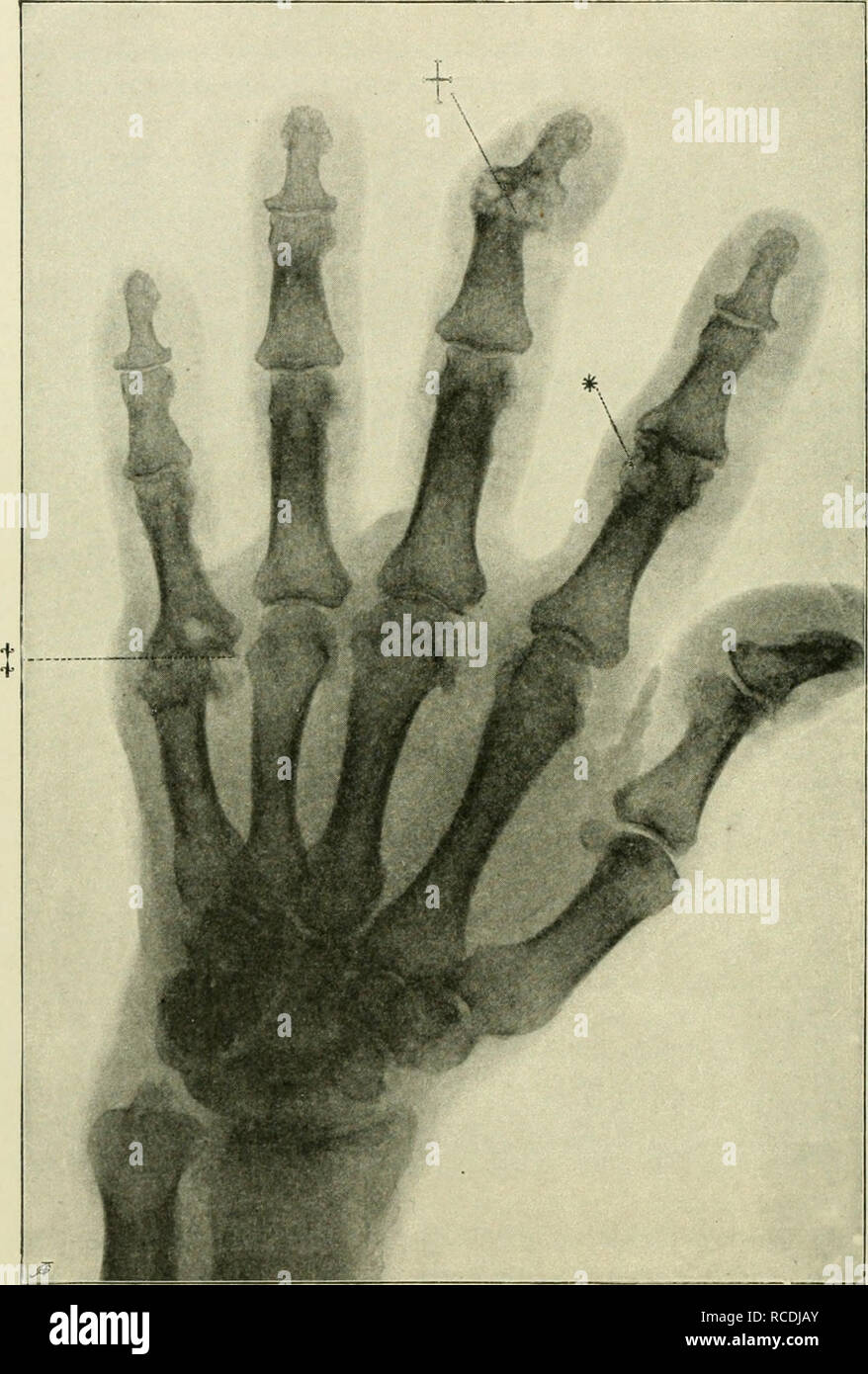 Dagger Sign Radiograph . Diseases of metabolism and of the blood, animal parasites, toxicology ...