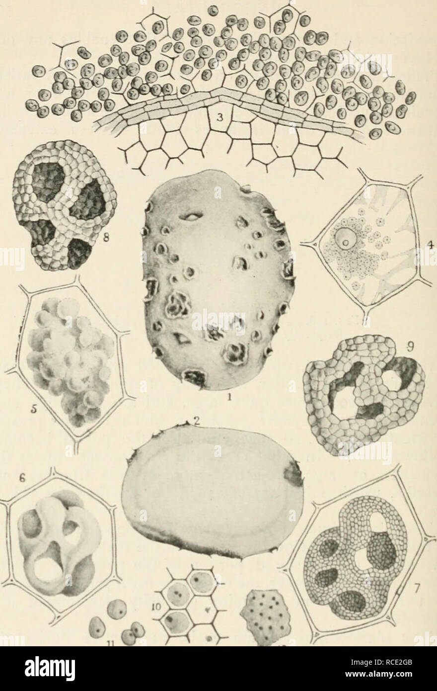 . Diseases of cultivated plants and trees. Plant diseases; Plants -- Wounds and injuries; Plants, Protection of; Trees -- Diseases and pests. Fig. 159.—Spongospora scabies. 1, tuber showing wuunds made during early development of the parasite; 2, section of same potato; 3, miture spore- balls of Spongospora ; 4, amoeboid bodies of Spo&gt;igospora in a potato cell, the starch has already disappeared; 5, showing the amoeboid bodies fused to form a Plasmodium in a ]&gt;otato cell; 6, a more advanced stage of the Plasmodium ; 7, the ()lasmodium in a still more advanced staj;e, showing its substanc Stock Photo