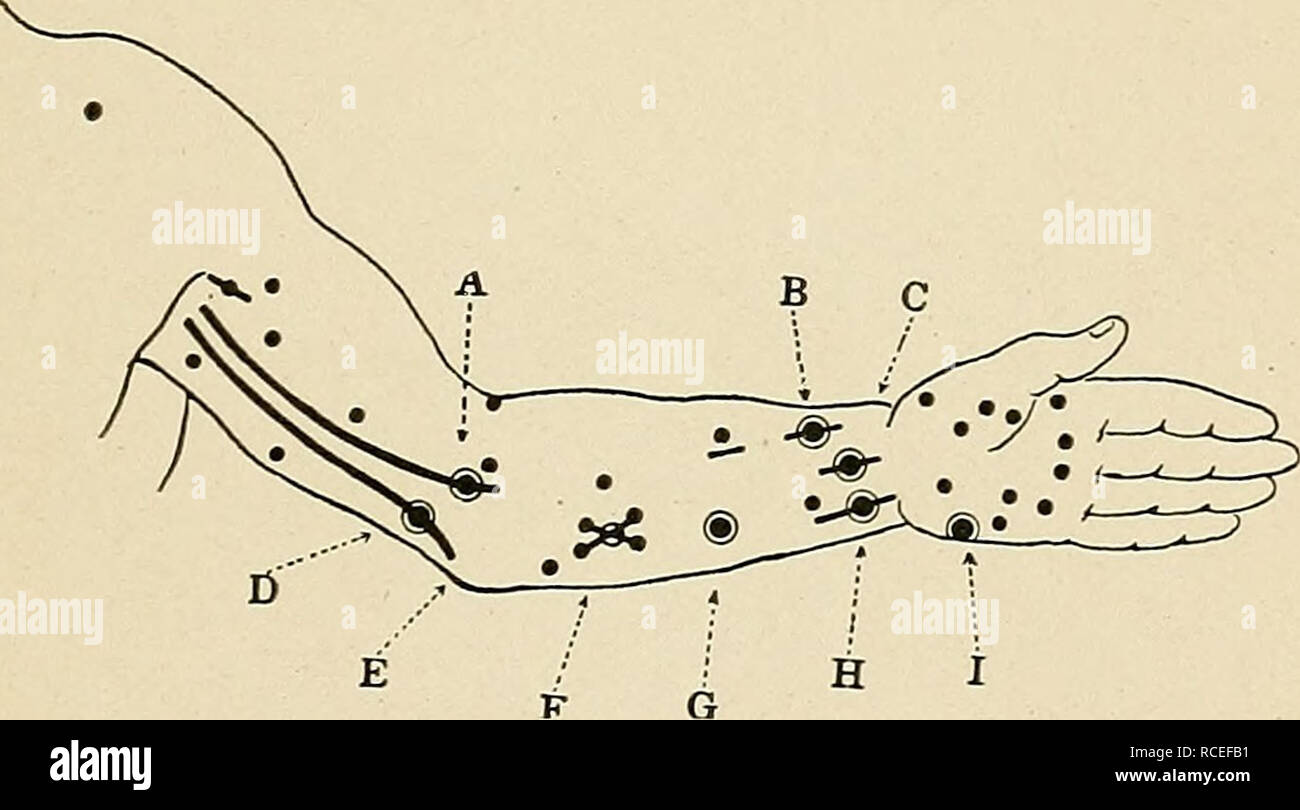 Directions For Laboratory Work In Physiology For The Use Of Medical Students Physiology Fig I6 Apparatus For Unipolar Excitation Of Liuman Nerves A Battery B Mercury Key C Primary Coil D