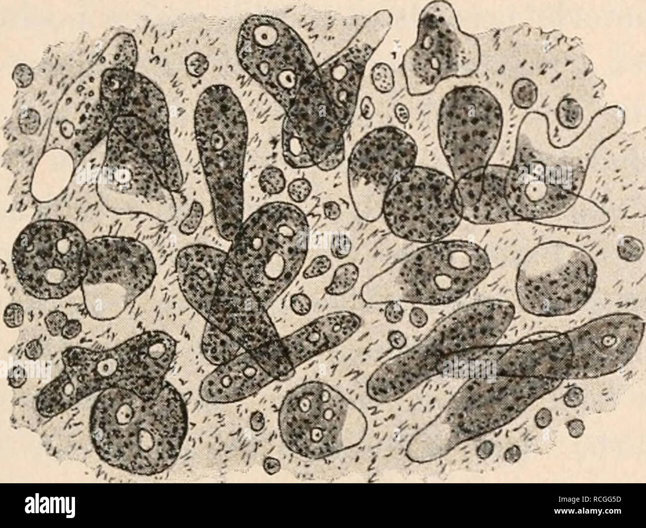 . Die Protozoen als Krankheitserreger des Menschen und der Hausthiere; für Ärzte, Thierärzte, und Zoologen. Pathogene Amöben. 17 versuchen, die besonders Kartulis^) angestellt hat als Erzeuger der Dysenterie hingestellt. Vor Kartulis hatte R. Koch gelegentHch seiner Cholera-Untersuchungen in Darmabschnitten von 4 zur Sektion gekommenen Fällen von ägyptischer Dysenterie Amöben gefunden. Ebenso in Leberabscessen derselben Fälle. Von anderen Autoren werden jedoch in diesen Fällen Mischinfektionen mit pathogenen Bakterien angenommen, weil es auch Amöben giebt, die nicht infektiös sind. Neuerdings Stock Photo