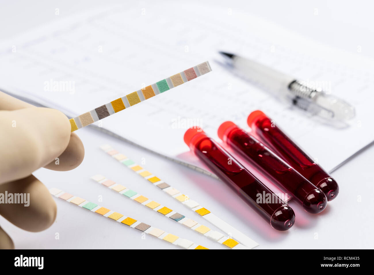 Test tubes with blood on white table with test chart and ballpoint pen ...