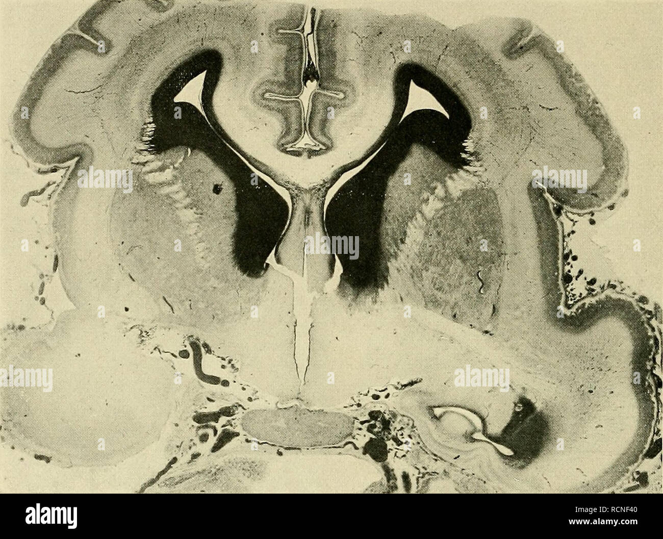 . Die Entwickelung des menschlichen Gehirns während der ersten Monate