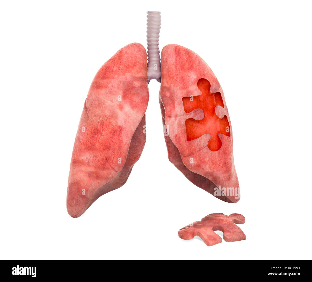 Lungs disease or infection concept, 3D rendering isolated on white background Stock Photo