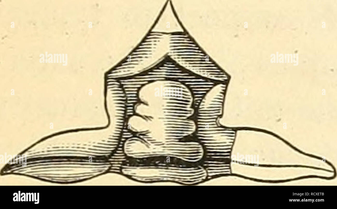 . Description of a new crustacean from the Clinton group of Georgia ... . ing directly from the cephalic shield in front of the glabella, and in this respect resembles Homalonotus rhinotropis of Angclin, a species which has been referred by Salter, in his Monograph of British Trilobites, to IT. Knightii. Salter says &quot; the front Fi?- 1- margin is of most singular structure and may be described as tricuspid. The nar- row edge is so deeply indented, and at the same time folded, that the front por- tion overhangs the rostral shield, forms i 'ai„„.cne ro.,rn,a Vogdes The 0^6 projectiug auglc f Stock Photo