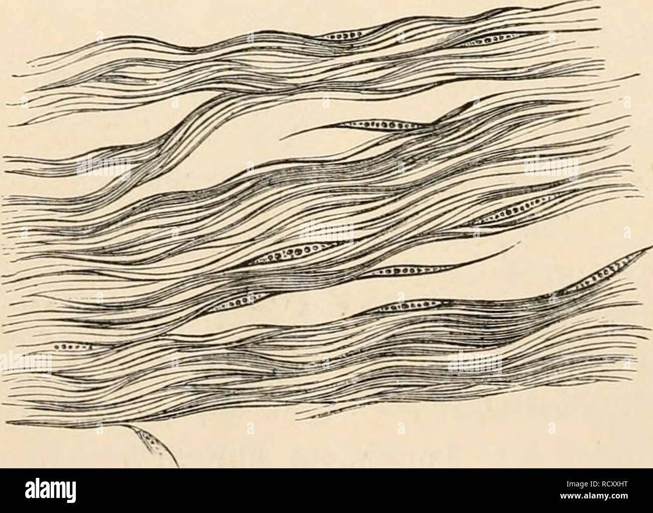 Adenoid Glands High Resolution Stock Photography and Images Alamy