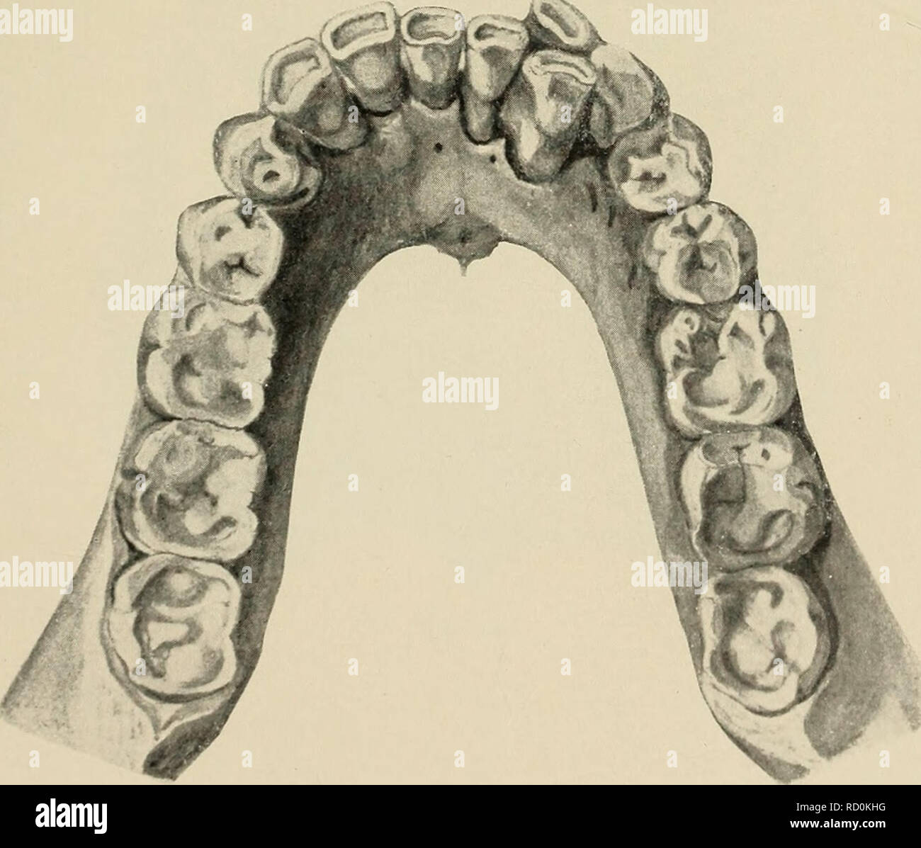 Das Gebiss des Menschen und der Anthropomorphen; vergleichend-anatomische  Unter-suchungen. Zugleich ein Beitrag zur mensch-lichen Stammesgeschichte.  Teeth; Human beings; Primates. 4 Fig. 20. Fig. 21a. Fig. 21b. Fig. 22. Fig.  23. Fig.