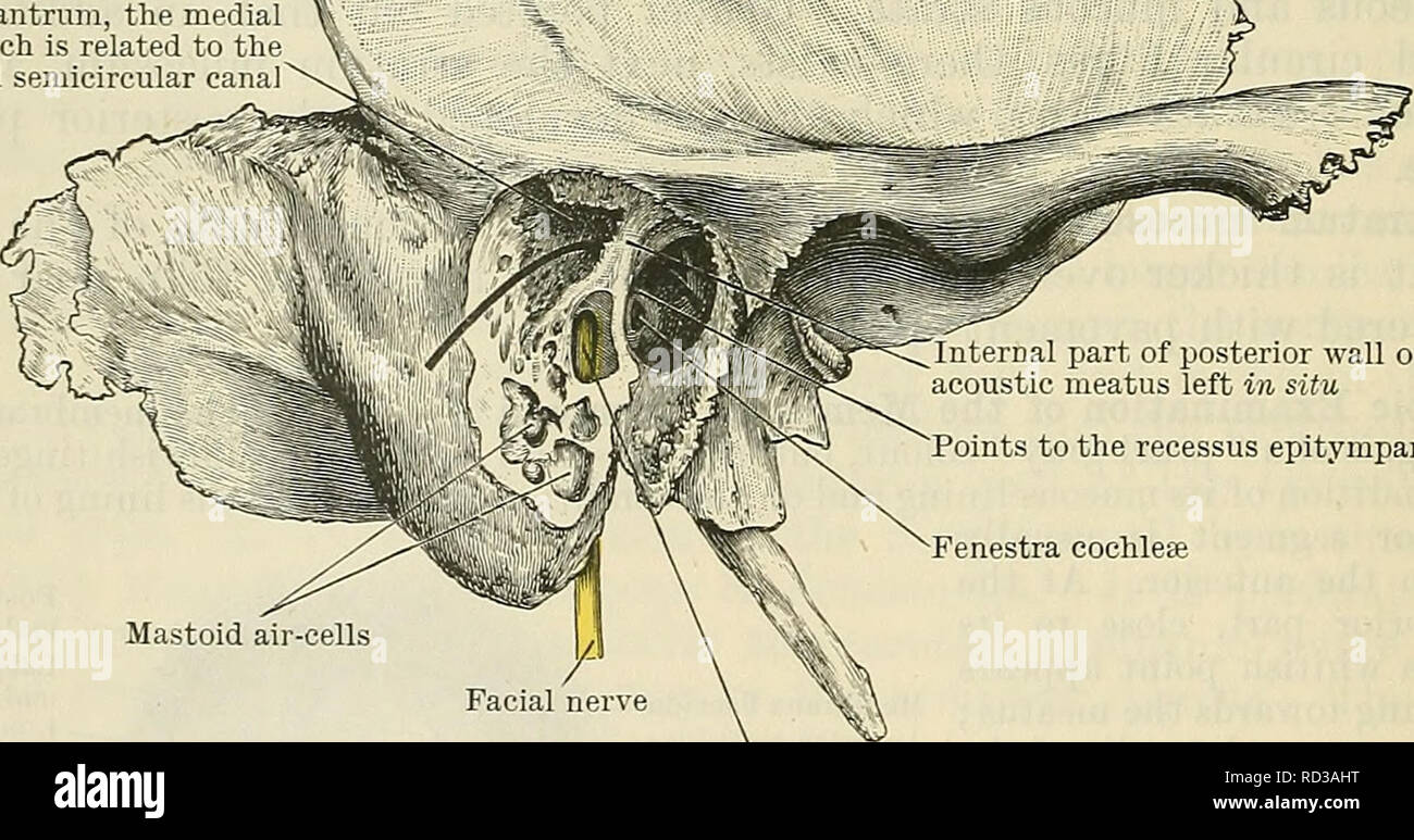 . Cunningham's Text-book of anatomy. Anatomy. Tympanic antrum, the medial  : wall of which is related to the 5 lateral semicircular canal. Internal part of posterior wall of external acoustic meatus left in situ Points to the recessus epitympanicus Fenestra cochleae Mastoid air-cells Facial canal laid open, displaying the facial nerve within Fig. 712. Preparation to display the position and relations of the tympanic antrum. The greater part of the posterior wall of the external acoustic meatus has been removed, leaving only a bridge of bone at its inner ex- tremity ; under this a bristle is Stock Photo