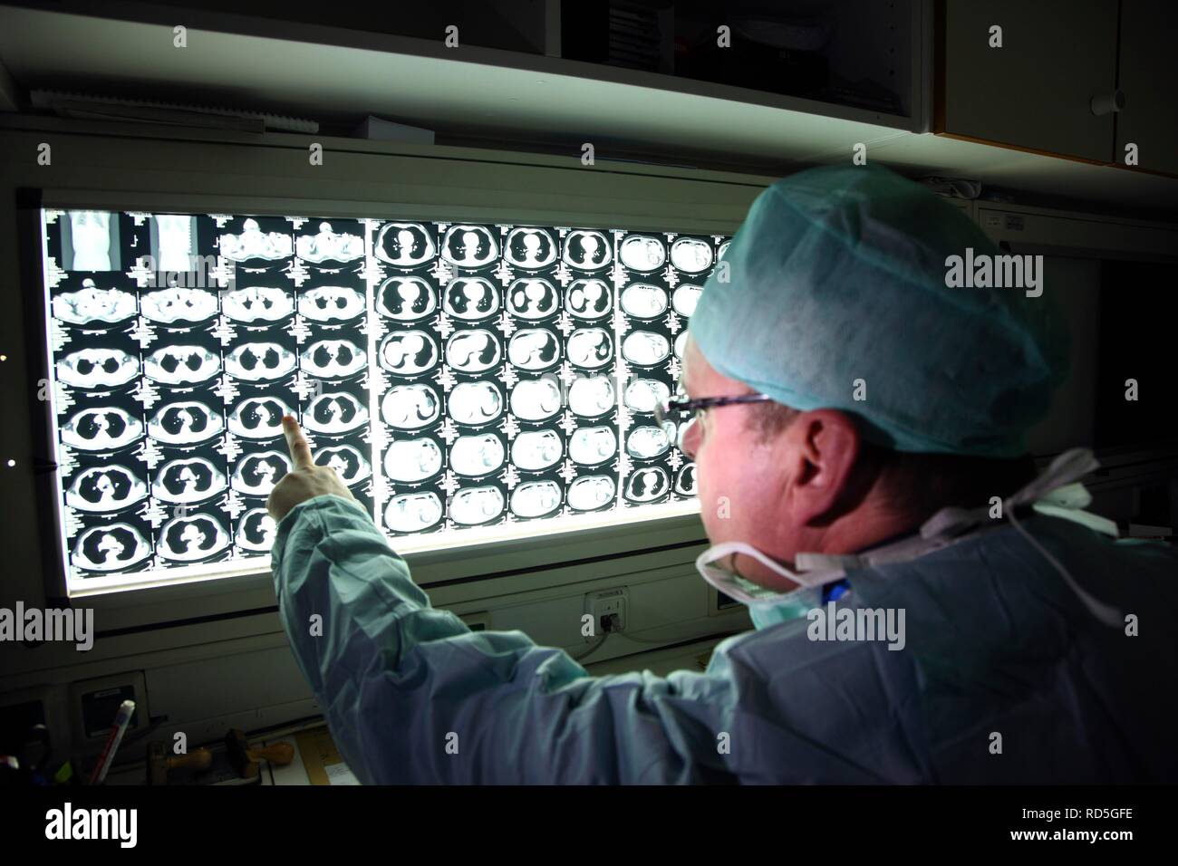 Doctor examining CT scans after a computer tomography, CT, cat-scan ...