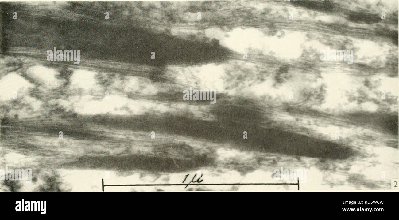 . Electron microscopy; proceedings of the Stockholm Conference ...