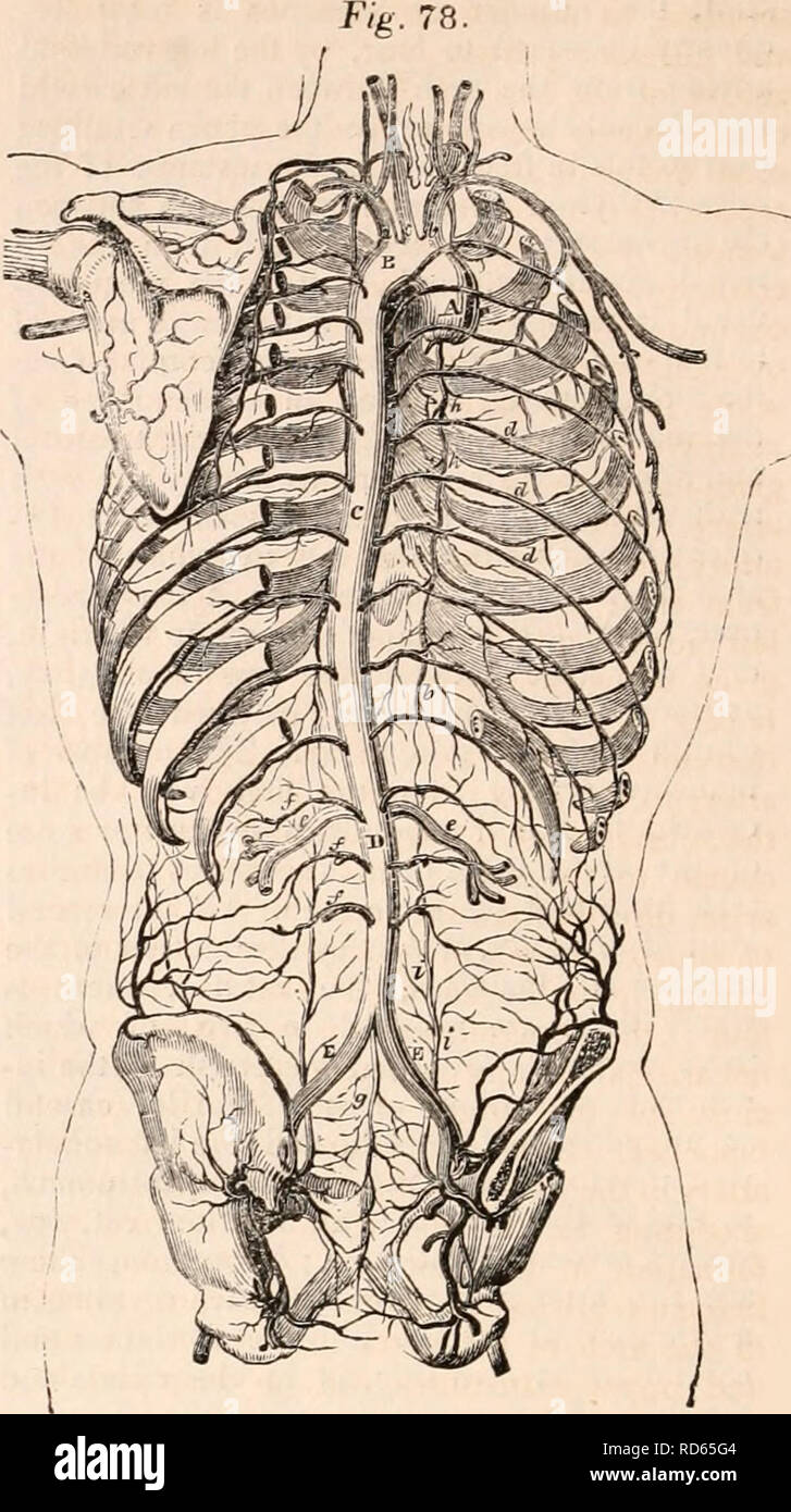 Axillw Aneurism of the aorta hi-res stock photography and images - Alamy