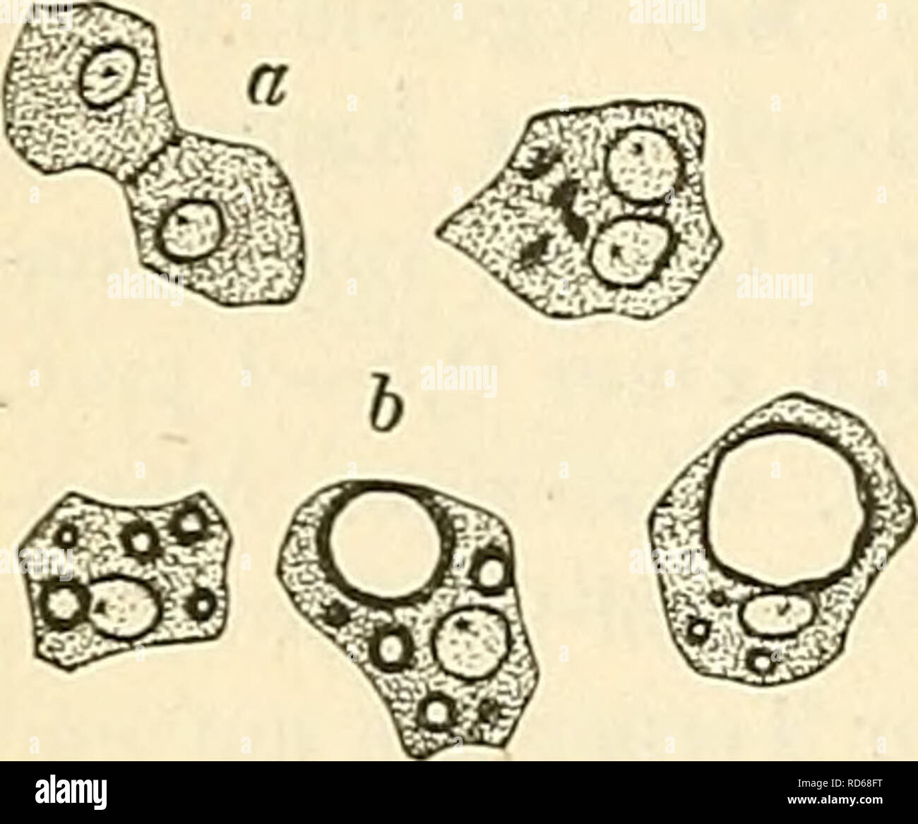 . Cursus der normalen Histologie zur Einführing in den Gebrauch des Mikroskopes, sowie in das practische Studium der Gewebelehre. Histology; Microscopy. 240 Die Organe, unregelmässige Gestalt und einen körnigen Leib, in welchem man ohne weiteres deutlich einen oder selbst zwei, relativ kleine, runde, sehr deutlich bläsclienförmige, mit Kernkörperchen versehene Kerne erkemit. Neben den geAVÖhnlichen, auf Essigsäurezusatz verschwin- denden Protoplasmakörnchen enthalten sie häufig eckige, gelbbraune Pigmentkörnchen, sowie kleinere oder grössere Fetttröpfchen. Die kleinen Petttröpfchen sind oft in Stock Photo