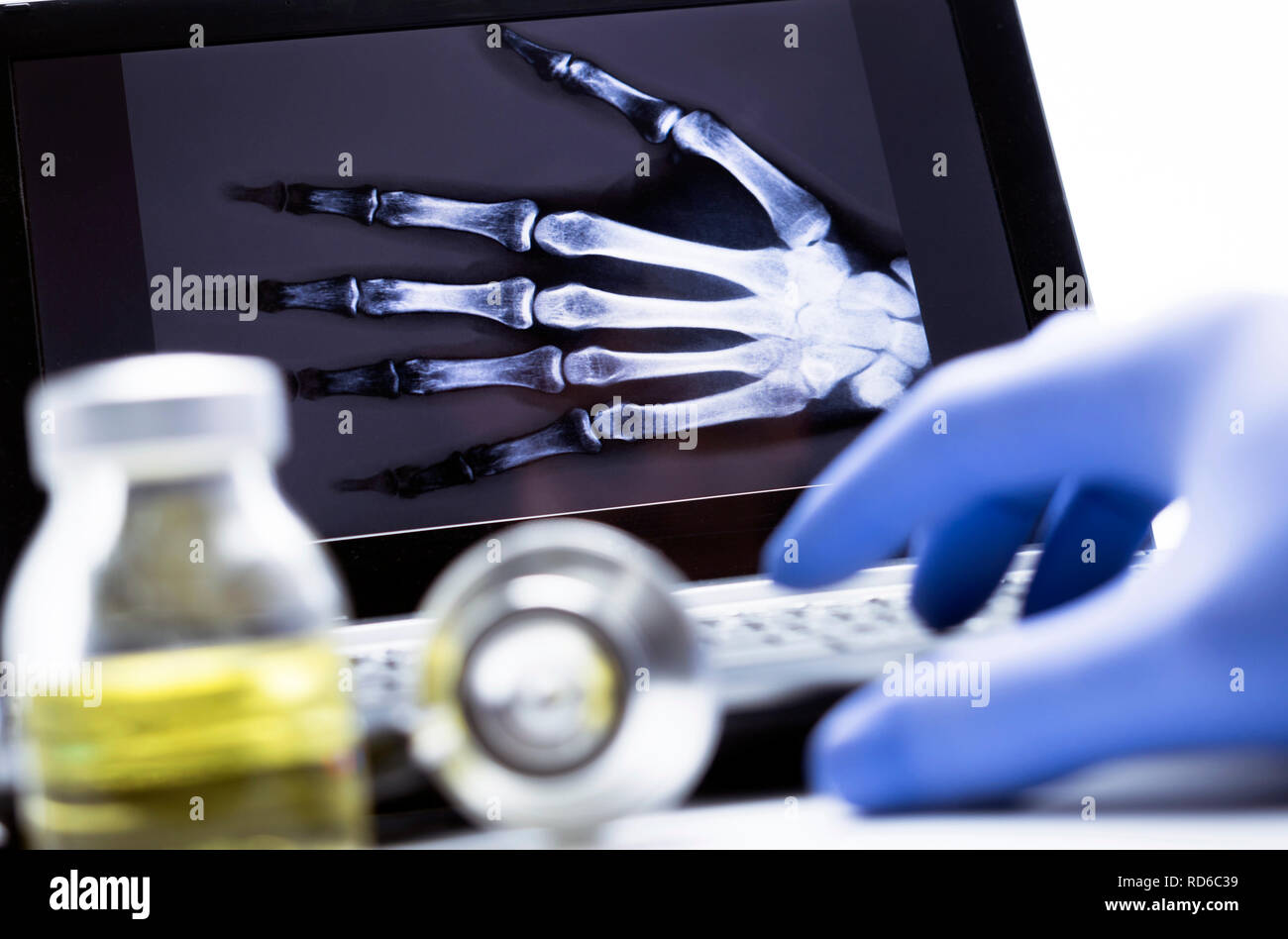 Hand radiography in hospital, conceptual image Stock Photo