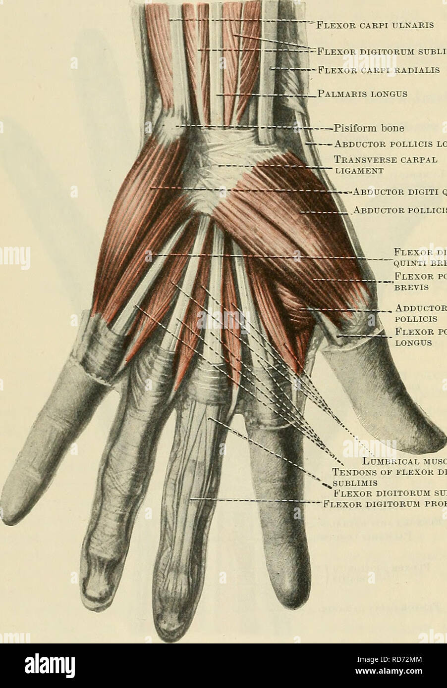 . Cunningham's Text-book of anatomy. Anatomy. 384 THE MUSCULAE SYSTEM. ance. &quot;Flexor carpi ulnaris -&quot;=Flexor digitorum sublimis 1—Flexor carpi radialis Palmar is longus —--Pisiform bone Abductor pollicis longus Transverse carpal ligament -Abductor digiti quinti Abductor pollicis brevis Flexor digiti quinti brevis Flexor pollicis 'brevis Adductor pollicis Flexor pollicis longus radiales longus and brevis, (3) Extensor pollicis longus, (4) Extensor digitorum communis and extensor indicis proprius, (5) Extensor digiti quinti propnus, (6) Extensor carpi ulnaris. The thin deep fascia of t Stock Photo