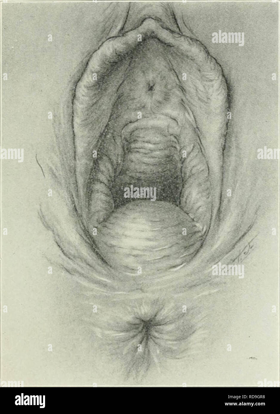 'American journal of obstetrics and gynecology' (1920) Stock Photo