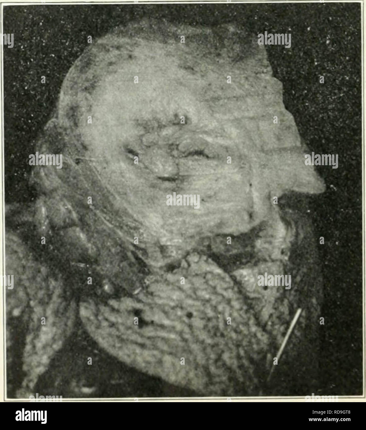 'American journal of obstetrics and gynecology' (1920) Stock Photo