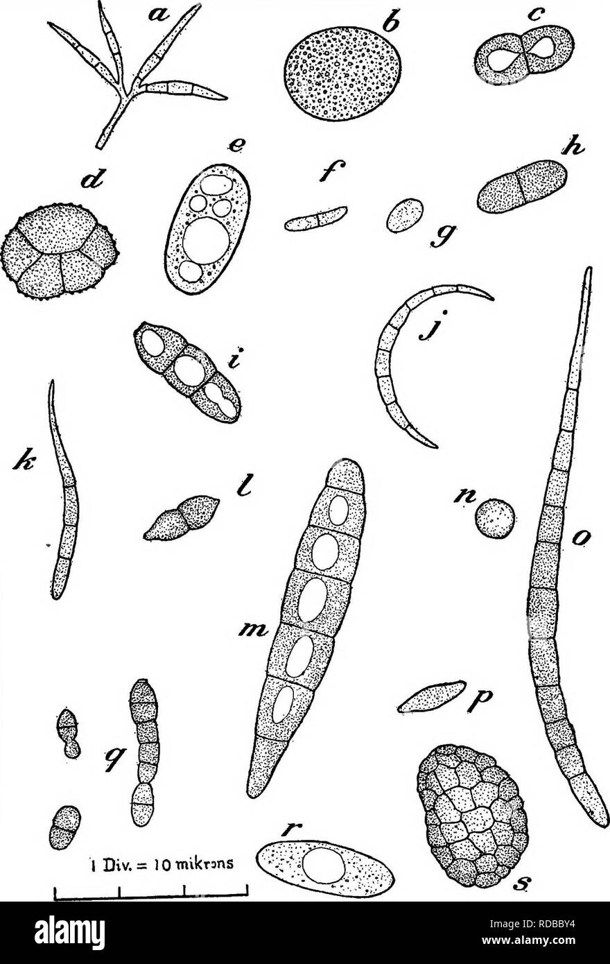 . Chestnut blight. Chestnut blight; Chestnut. Sept. SI, 1914 Birds and Chestnut Blight 419. Fig . -Types of spores other than those of Endathia parasitica obtamed by the microscopic exammatoa o L c^uged^edhnent from the test of bird No. .3. a brown creeper. Brown-spored forms appear to ^!do^&quot;e ., Hyaline; b. hyaline; ., dark brovm; d. nearly black; .. hyahne; /. hght brown; ,. loky;7^l&quot;mokyr.-. dark smoky; /, hyaline; k. pale smoky; /, dark smoky; «. smoky; „. hyaUne; o. brown; P. hyaline; «, dark smoky; r. hyaline; s. very dark, ahnost black.. Please note that these images are extra Stock Photo