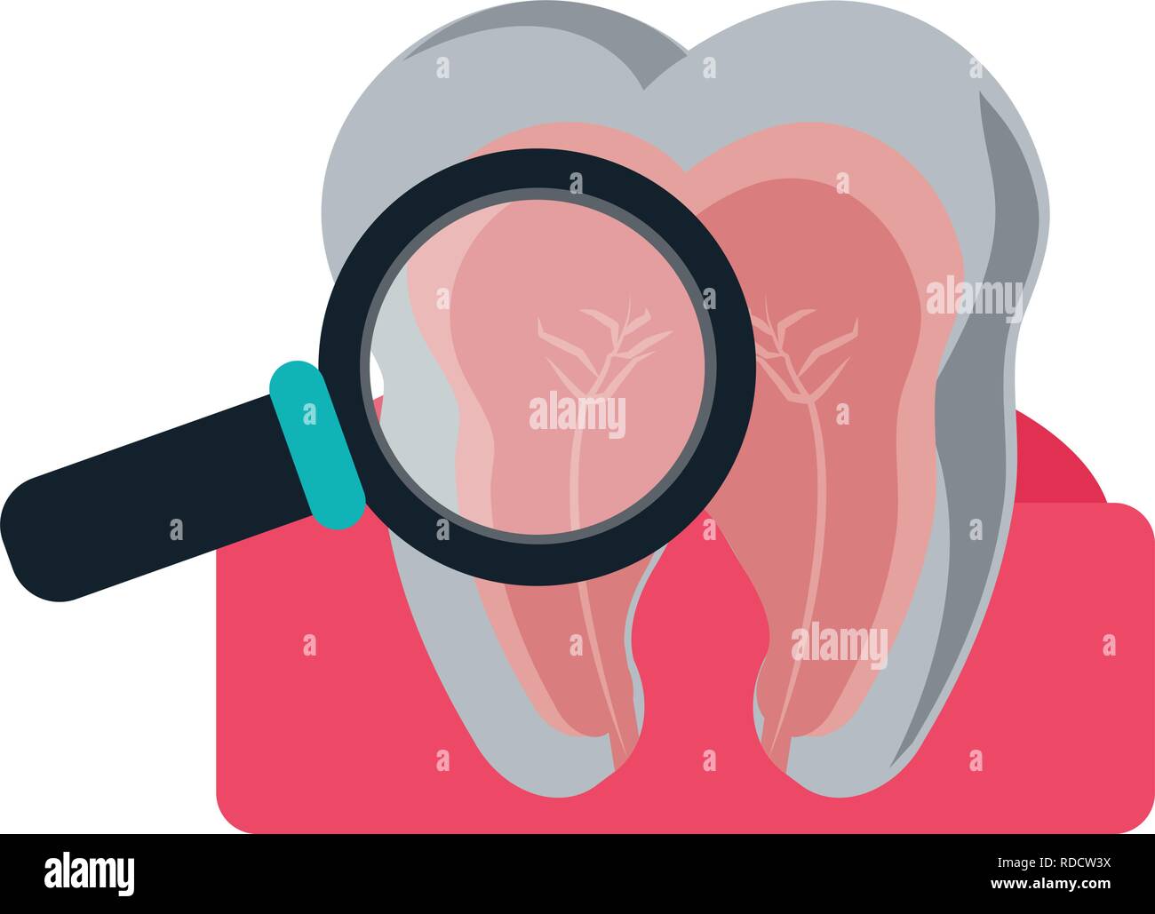 Medical Dental treatment Stock Vector Image & Art - Alamy