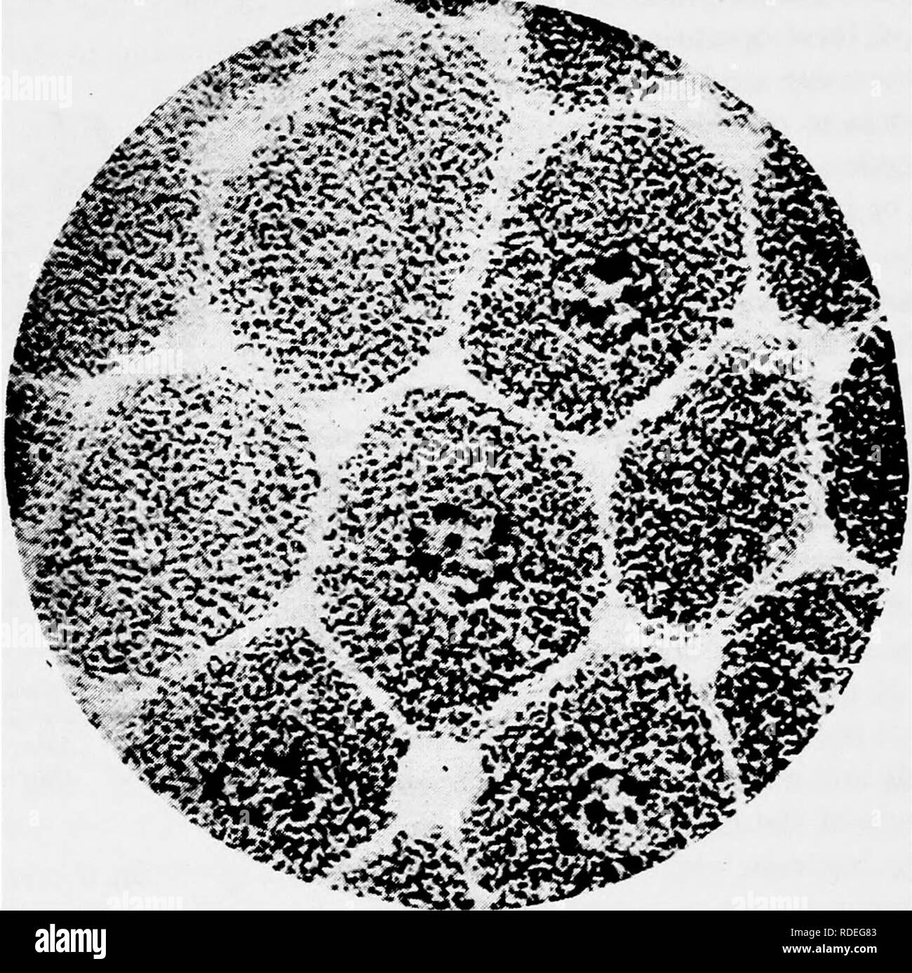 . A text-book of mycology and plant pathology . Plant diseases; Fungi in agriculture; Plant diseases; Fungi. 3Â° MYCOLOGY (Fig. 9). The presence of these bacteria causes the formation of swell- ings, tubercles, or nodules on the roots of the leguminous plants. Here Bacillus radicicola remains, utilizing free atmospheric nitrogen until about the time of flowering of the host, when it begins to assume in- volution forms, enlarging considerably and assuming S-shaped or Y-shaped forms (Fig. 10). Then they are gradually absorbed by the . â &quot;'vwr^. Fig. 9.âCells of root tubercle of Lupinus angu Stock Photo