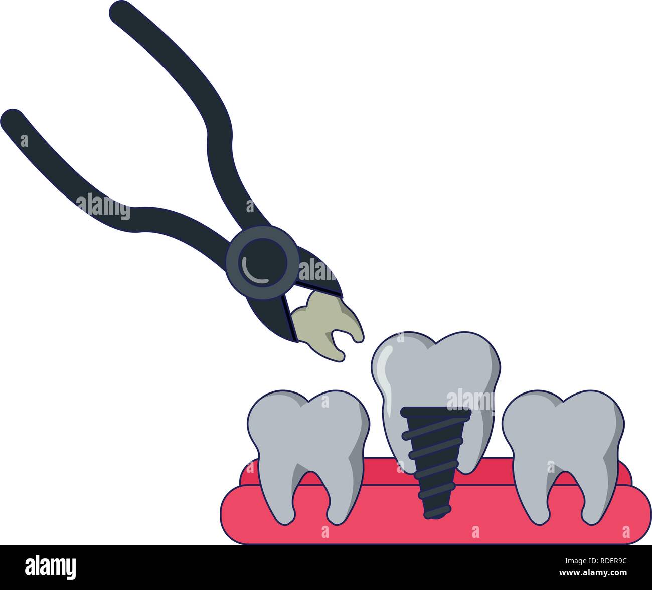Medical Dental treatment Stock Vector Image & Art - Alamy