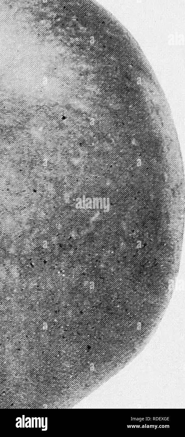 Yellowing skin hires stock photography and images Alamy