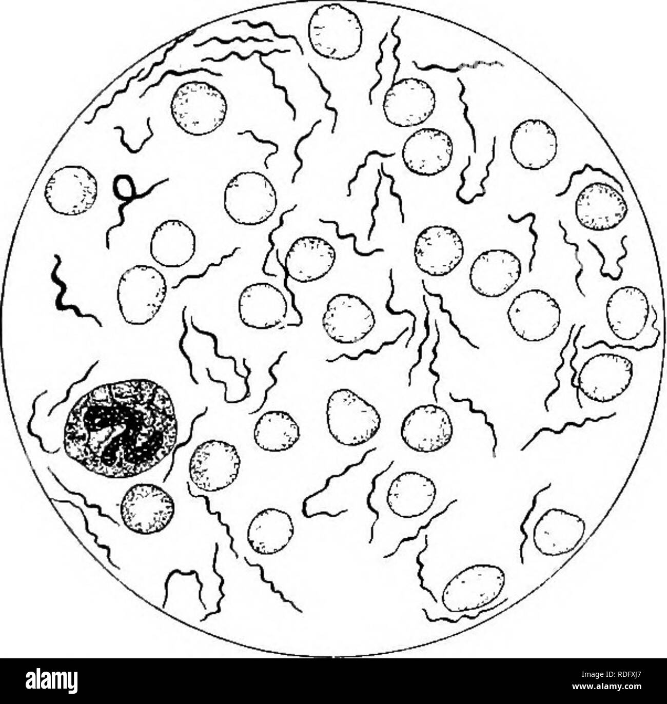 Spirochaetosis hires stock photography and images Alamy