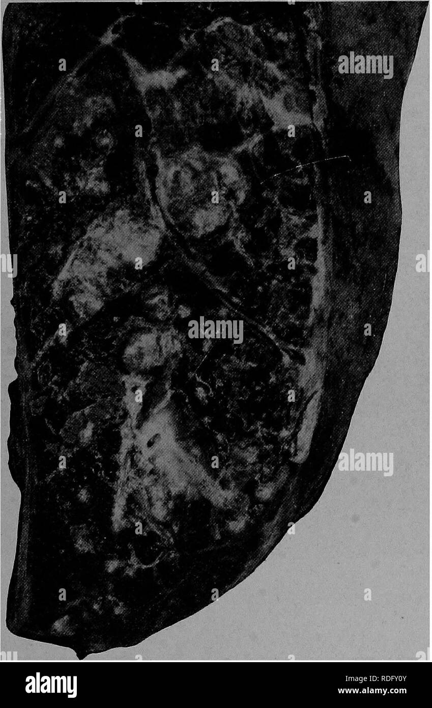 . The pathology and differential diagnosis of infectious diseases of