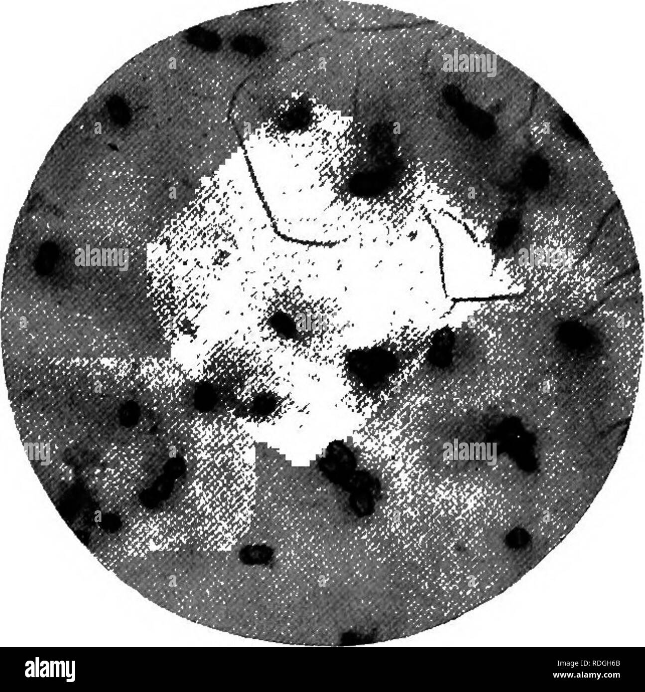 Azotobacter hi-res stock photography and images - Alamy
