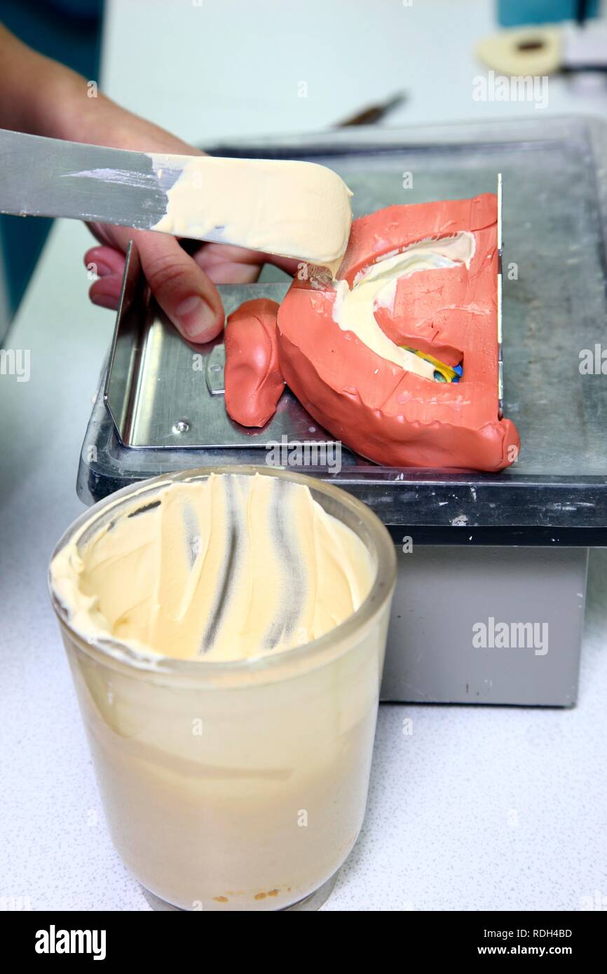 Dental laboratory, manufacture of a dental prostheses by a master craftsman, making a plaster cast Stock Photo