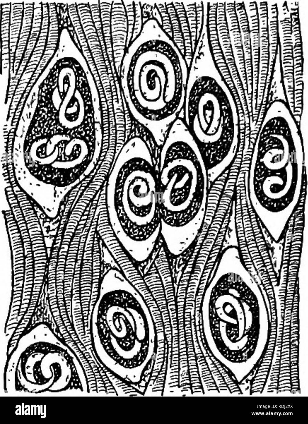 Trichinella spiralis Black and White Stock Photos & Images - Alamy