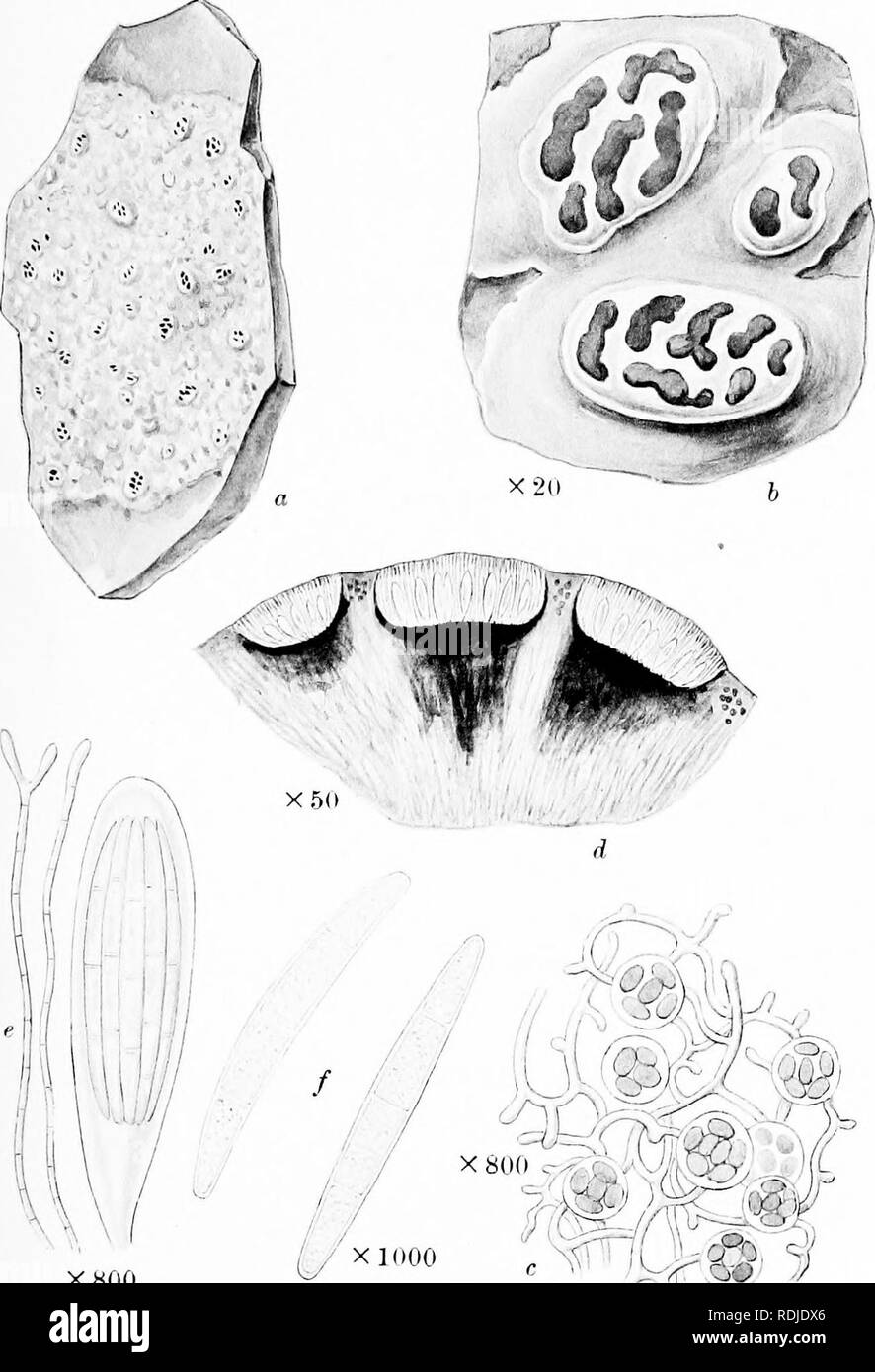 . A monograph of lichens found in Britain; being a descriptive catalogue of the species in the herbarium of the British Museum. Lichens. Plate 32. XSOO CHIODECTON ALBIDUM Leight, a. Plant on rock. b. Portion of tballus and apothecia. c. Vertical section of thallus. d. Vertical section of apothecia. e. Ascus and paraphyses. /. Spores.. Please note that these images are extracted from scanned page images that may have been digitally enhanced for readability - coloration and appearance of these illustrations may not perfectly resemble the original work.. British Museum (Natural History). Dept. of Stock Photo