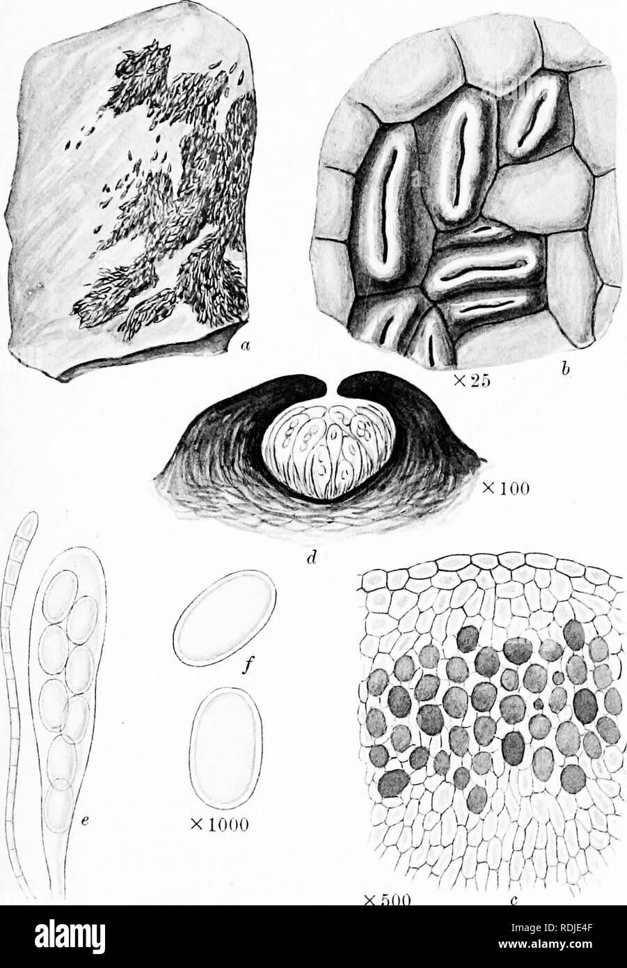 . A monograph of lichens found in Britain; being a descriptive catalogue of the species in the herbarium of the British Museum. Lichens. Plate 22. X 500 X500 LITHOGRAPHA TESSEIIATA JSfyl. a. Plant on rock. b. Portion of thallus and apothecia. c. Vertical section of thallus, d. Vertical section of apothecium. c. Ascus and paraphysi /. Spores.. Please note that these images are extracted from scanned page images that may have been digitally enhanced for readability - coloration and appearance of these illustrations may not perfectly resemble the original work.. British Museum (Natural History).  Stock Photo