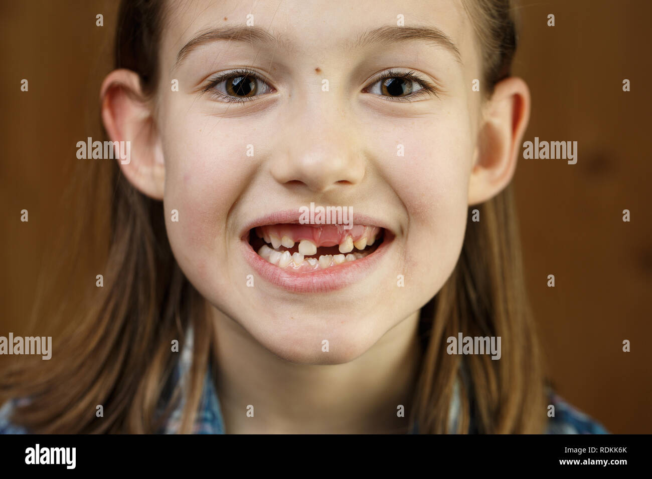 Little girl smiling, showing her missing milk teeth. Playful, cheerful childhood, tooth fairy, growth and milestone concept. Stock Photo