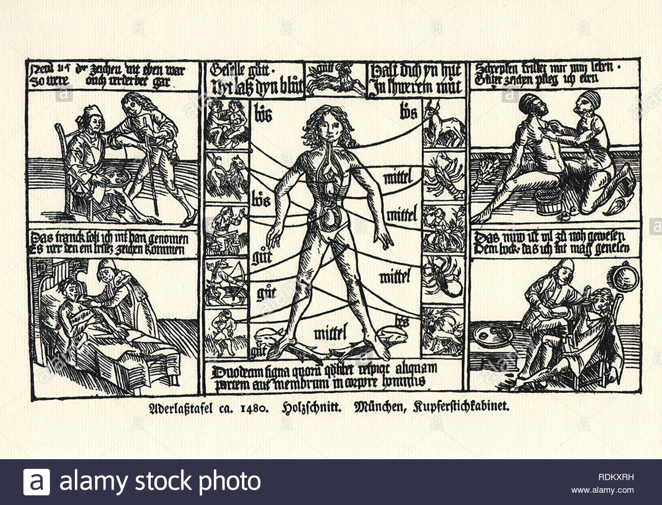 Bloodletting Stock Photos & Bloodletting Stock Images Alamy