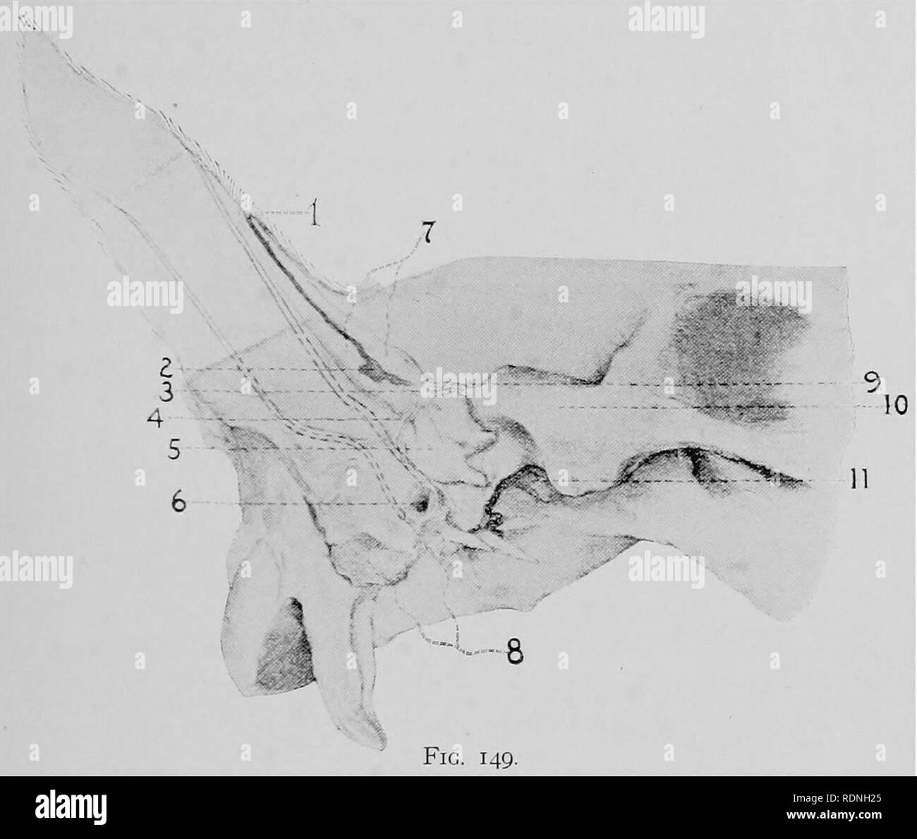 . Veterinary surgery ... Veterinary surgery; Veterinary pathology; Horses; Teeth; Domestic animals. ANIMAL DENTISTRY. 221. Fig. 149. Dental Teratoma and Conchal Fistula. 1. Mouth of the conchal fistula. 2. Bottom of the fistulous tract. 3. Gubernaculum dentis. 4. 9. Bony plates from the temporal.bone. 5. The tooth. 6. External auditory meatus. 7. Wall of the fistulous tract. 8. Petrous temporal bone. 10. Zygoma. 11. Temporo-maxillary articulation. (Williams).. Please note that these images are extracted from scanned page images that may have been digitally enhanced for readability - coloration Stock Photo