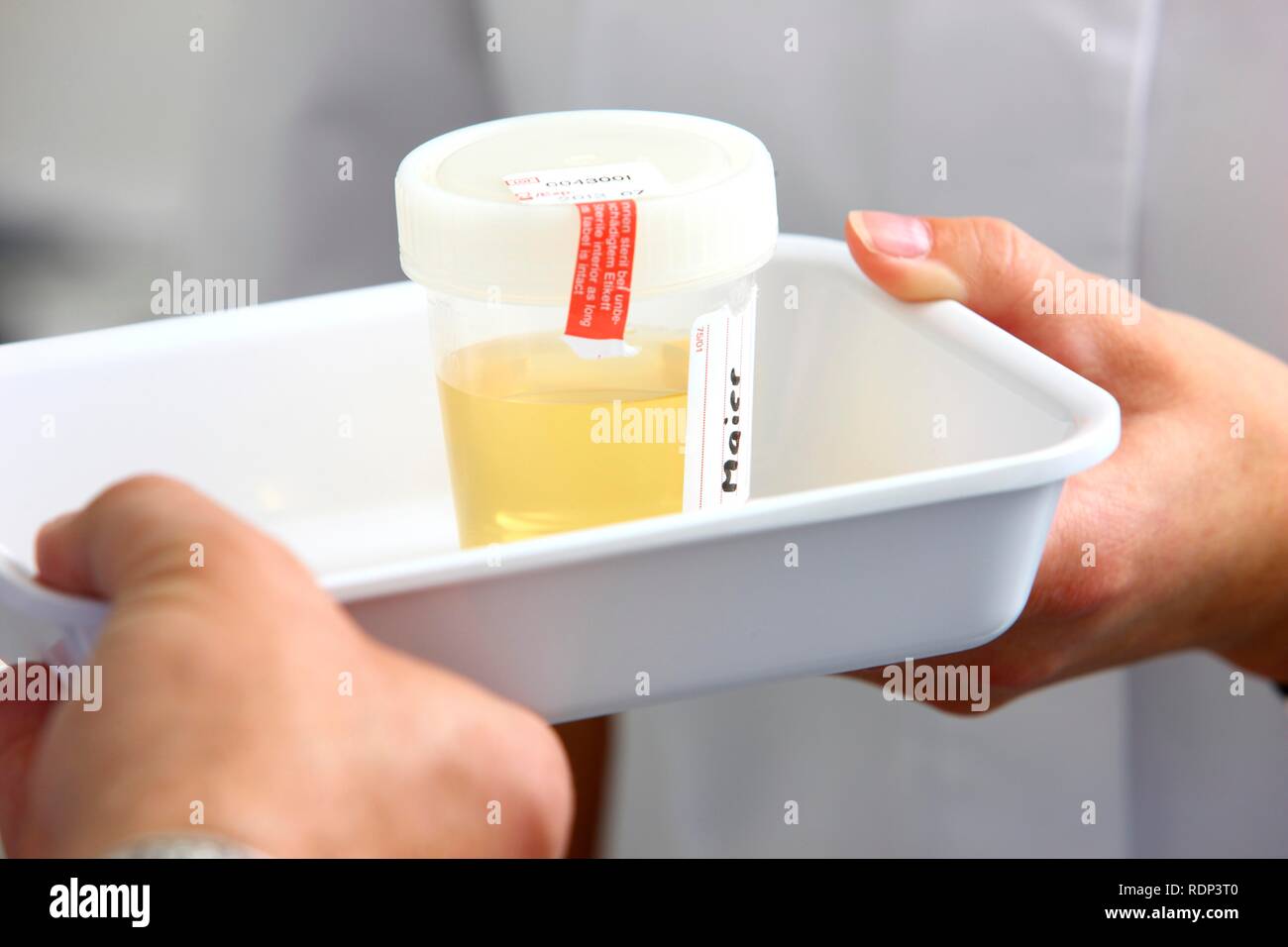 Doctor's surgery, collection of an urine sample for laboratory analysis