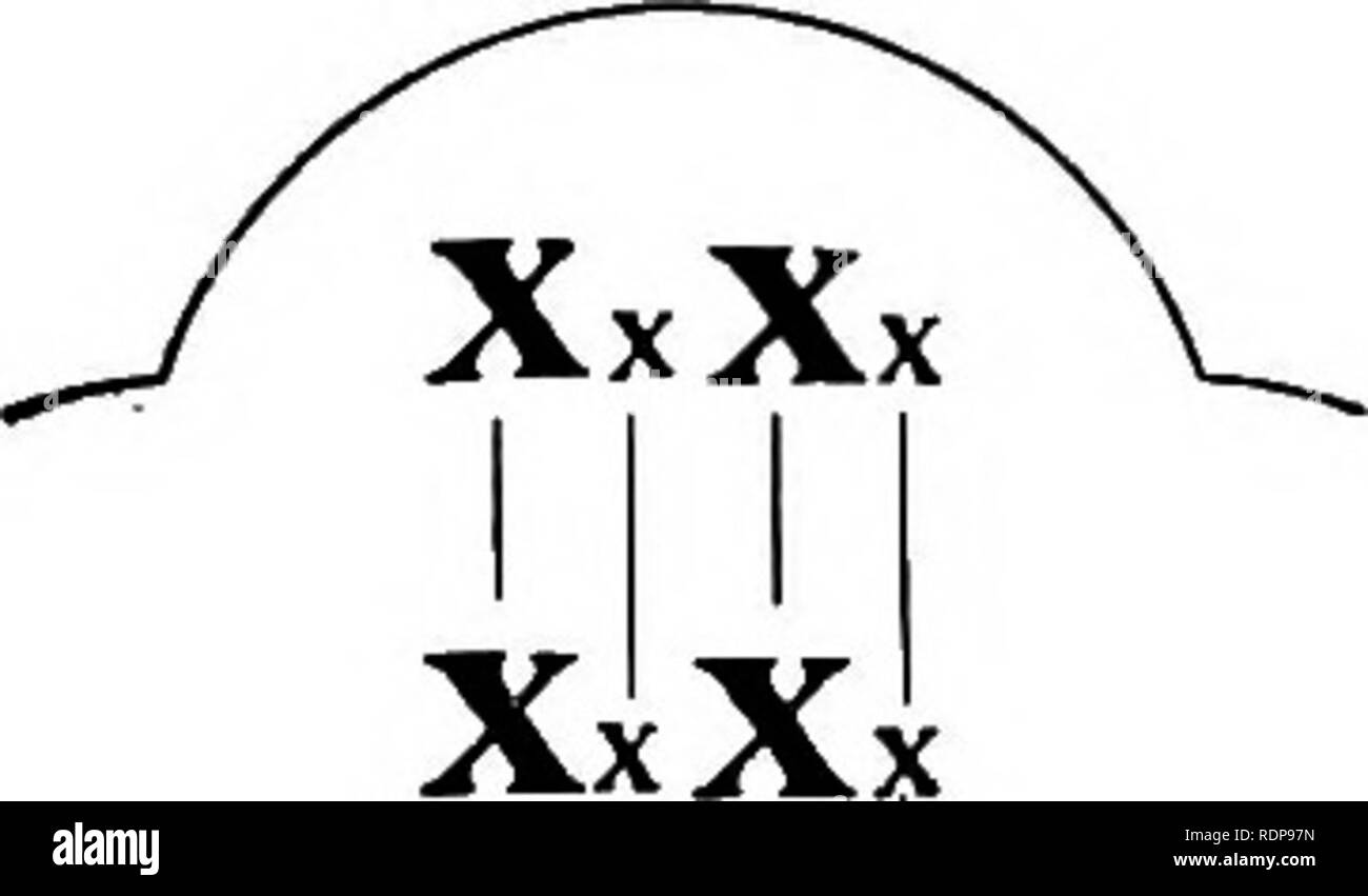 Chromosome xxxx 48,XXXX