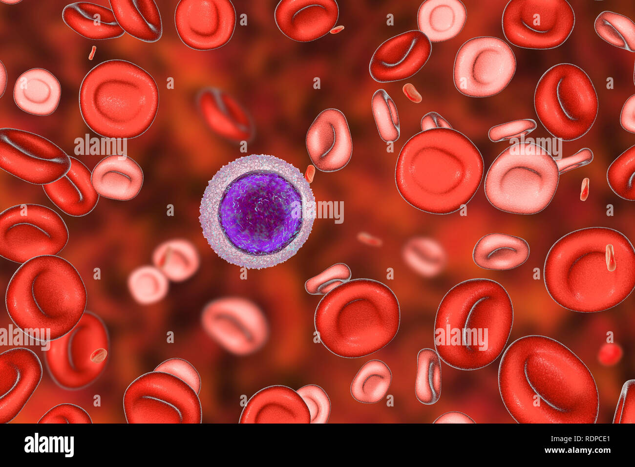 Hypochromic Red Blood Cell Captions Swap