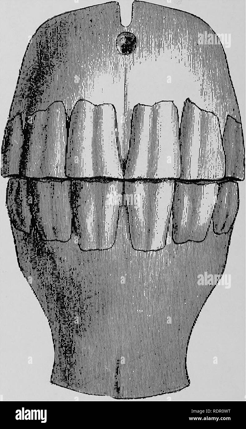 . Veterinary surgery ... Veterinary surgery; Veterinary pathology; Horses; Teeth; Domestic animals. 28 ANIMAL DENTISTRY. facial. They have the same general distribution as the ar- teries, the courses of which they follow, into the pulp cavity.. Fig. 10. Incisor Teeth of a Mature Horse, Anterior View. PERMANENT INCISOR TEETH OF A HORSE. The incisor tooth of a horse presents the form of a curved pyramid with the greater curvature forward, the base out- ward and the apex implanted deeply into the alveolar cavity. Please note that these images are extracted from scanned page images that may have b Stock Photo