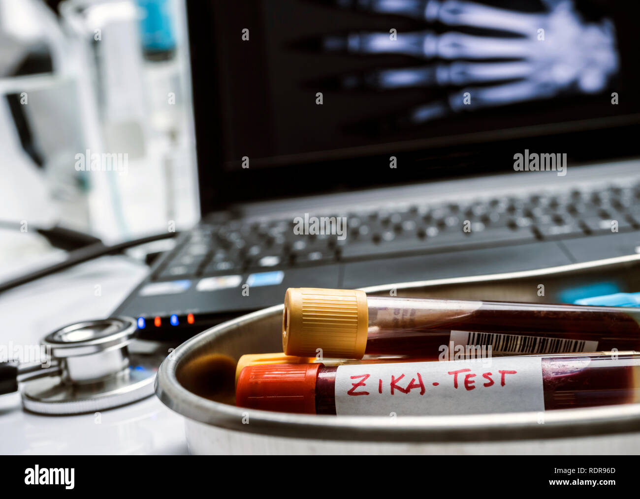 Test of zika virus, blood sample in a hospital, conceptual image Stock