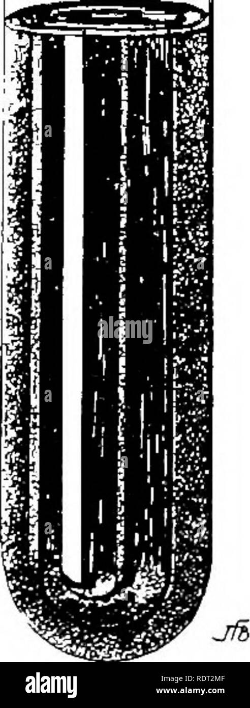 . Bacteria in relation to plant diseases. Bacteriology; Plant diseases. INDOL, PHENOL, ETC. 6:. d for five minutes (70° to 80° C). The browniiifj of media due to excess of sodiuiu nitrite must not be mistaken for this pink or red reaction. Uninoculated tubes should be inchided in the test, wliich may be made on the second and tenth day. For methods of determining phenol see Lewandowski in Deutsche Med. Wochenschrift, 1890, p. 1186, and Chester's Manual, p. t,;},. Schmidt (Bd. II, p. 1008) gives the following as a qualitative reaction for tyrosiu : Dissolve !:&gt;}' boiling in water and add a s Stock Photo